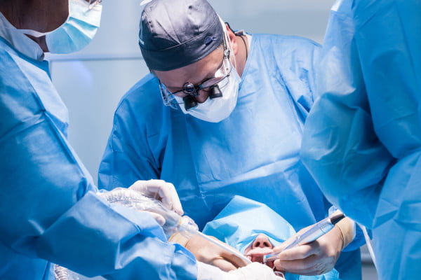 chirurgie dentara