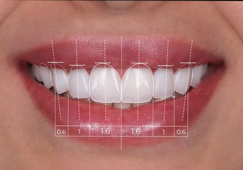 fatete dentare