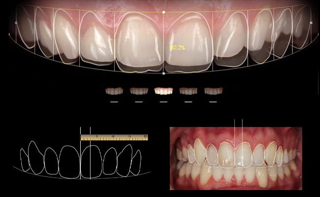 fatete dentare