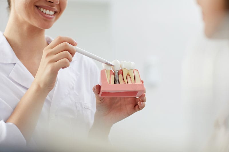 implant dentar